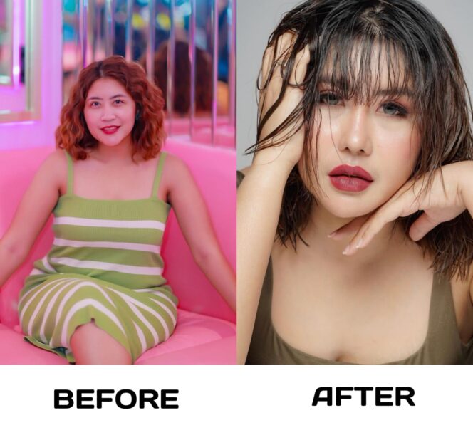 
					Operasi Kedua di Korea Selatan, Aprilia Sky Tampil Lebih Muda dan Percaya Diri