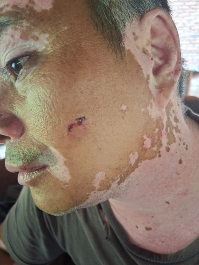 
					Usai Jadi Tersangka, Ayah dan Anak di Langkat Diduga “Playing Victim”, Kuasa Hukum Korban Angkat Bicara